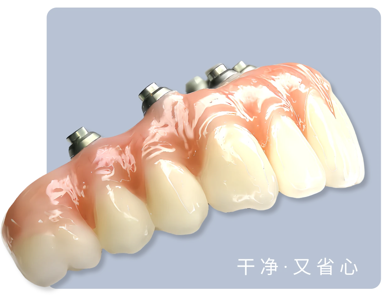 全覆瓷义齿应用效果