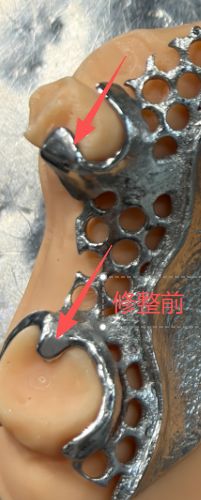 1126081817927 可摘局部义齿支架 设计问题描述图一（PSE 片面记录卡）
