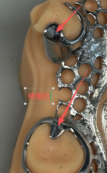1126081817927 可摘局部义齿支架 设计问题描述图二（PSE 片面记录卡）