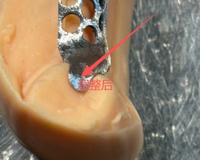 1126082438464 可摘局部义齿支架 设计问题描述图二（PSE 片面记录卡）