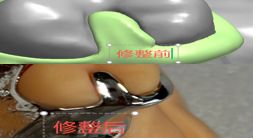 1126082468470 可摘局部义齿支架 设计问题描述图二（PSE 片面记录卡）
