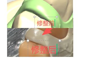1126082488414 可摘局部义齿支架 设计问题描述图二（PSE 片面记录卡）