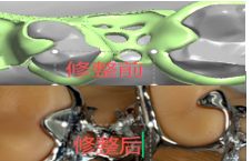 1126082598582 可摘局部义齿支架 设计问题描述图一（PSE 片面记录卡）