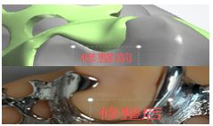 1126082598582 可摘局部义齿支架 设计问题描述图二（PSE 片面记录卡）