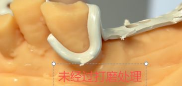 1126090159176 可摘局部义齿支架 设计问题描述图一（PSE 片面记录卡）