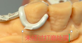 1126090159176 可摘局部义齿支架 设计问题描述图二（PSE 片面记录卡）