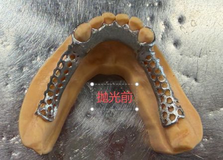 1126090449488 可摘局部义齿支架 设计问题描述图一（PSE 片面记录卡）