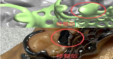 1126090969960 可摘局部义齿支架 设计问题描述图二（PSE 片面记录卡）