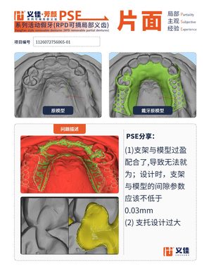 1126072756065-01 可摘局部义齿支架 PSE 片面记录卡案例