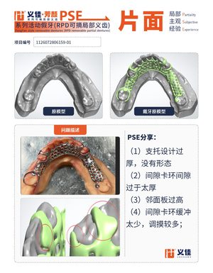1126072806159-01 可摘局部义齿支架 PSE 片面记录卡案例
