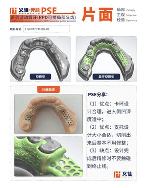 1126072836189-01 可摘局部义齿支架 PSE 片面记录卡案例