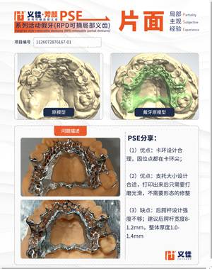 1126072876167-01 可摘局部义齿支架 PSE 片面记录卡案例