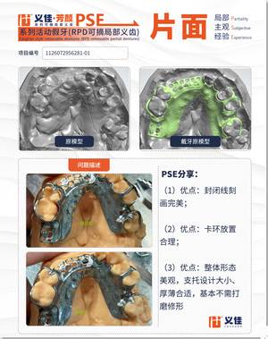 1126072956281-01 可摘局部义齿支架 PSE 片面记录卡案例