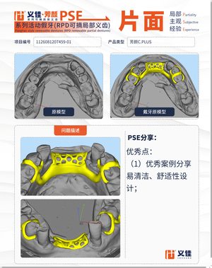 1126081207459-01 可摘局部义齿支架 PSE 片面记录卡案例