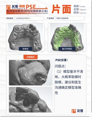1126081227493-1 可摘局部义齿支架 PSE 片面记录卡案例