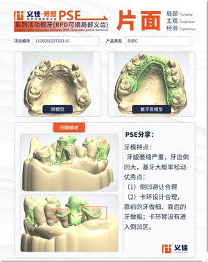 1126081237503-01 可摘局部义齿支架 PSE 片面记录卡案例
