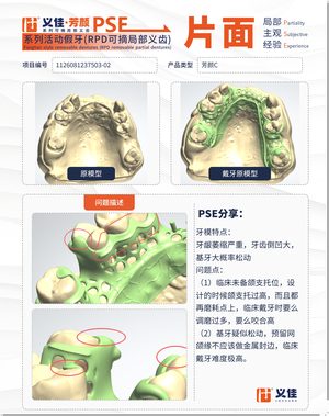 1126081237503-02 可摘局部义齿支架 PSE 片面记录卡案例