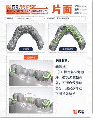 1126081287491-1 可摘局部义齿支架 PSE 片面记录卡案例