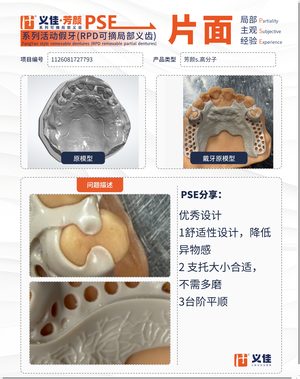 1126081727793 可摘局部义齿支架 PSE 片面记录卡案例