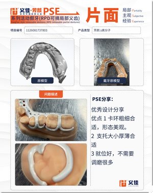 1126081737803 可摘局部义齿支架 PSE 片面记录卡案例