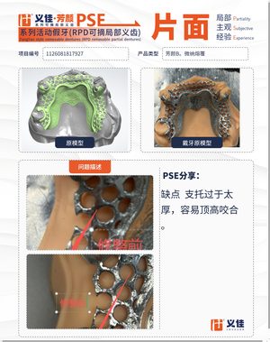 1126081817927 可摘局部义齿支架 PSE 片面记录卡案例