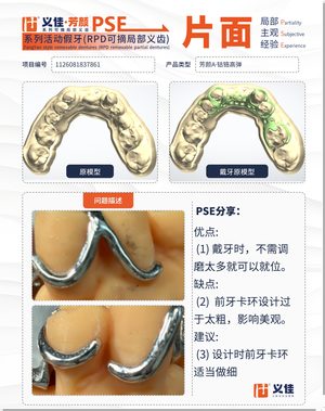 1126081837861 可摘局部义齿支架 PSE 片面记录卡案例