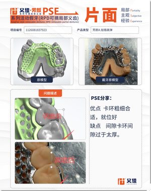1126081837923 可摘局部义齿支架 PSE 片面记录卡案例