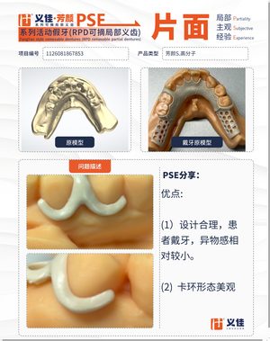 1126081867853 可摘局部义齿支架 PSE 片面记录卡案例