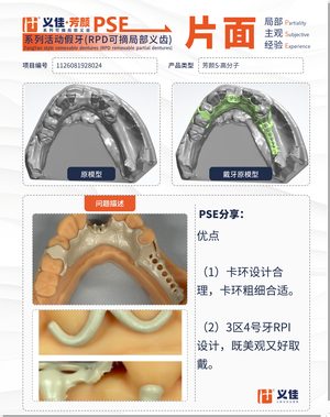 1126081928024 可摘局部义齿支架 PSE 片面记录卡案例