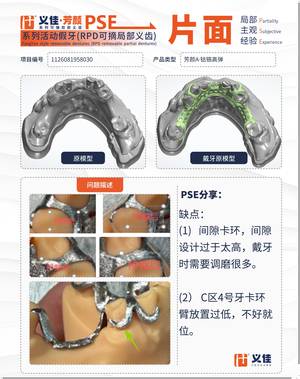 1126081958030 可摘局部义齿支架 PSE 片面记录卡案例
