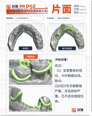 1126082088110 可摘局部义齿支架 PSE 片面记录卡案例