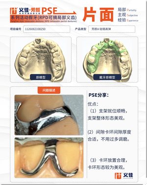 1126082108250 可摘局部义齿支架 PSE 片面记录卡案例