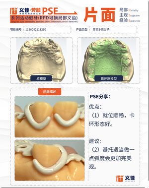 1126082118260 可摘局部义齿支架 PSE 片面记录卡案例