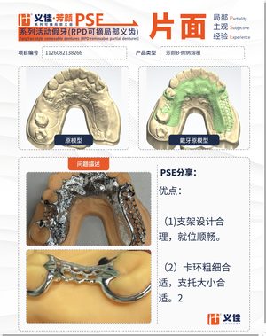 1126082138266 可摘局部义齿支架 PSE 片面记录卡案例