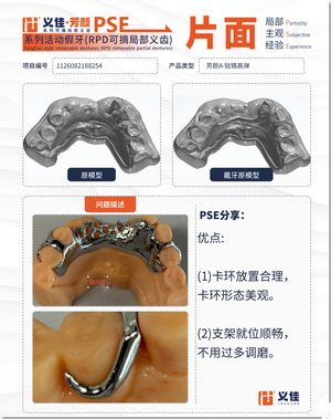 1126082188254 可摘局部义齿支架 PSE 片面记录卡案例