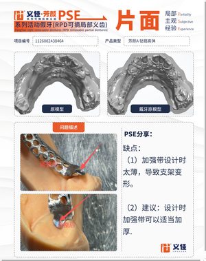 1126082438464 可摘局部义齿支架 PSE 片面记录卡案例