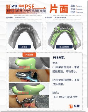 1126082458422 可摘局部义齿支架 PSE 片面记录卡案例