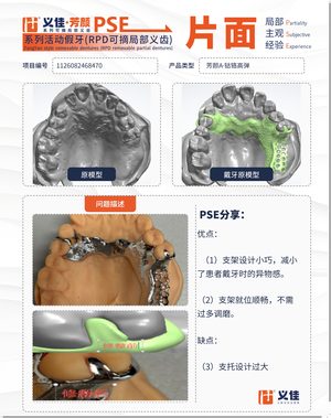1126082468470 可摘局部义齿支架 PSE 片面记录卡案例
