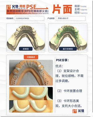 1126082478428 可摘局部义齿支架 PSE 片面记录卡案例