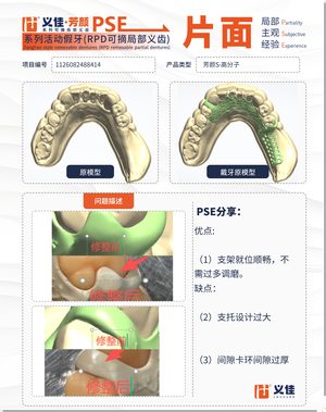 1126082488414 可摘局部义齿支架 PSE 片面记录卡案例