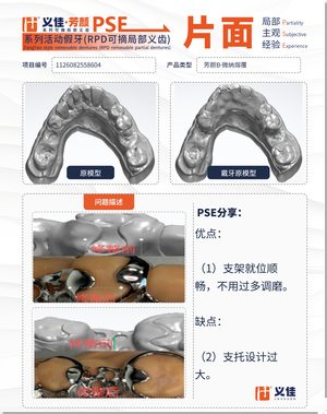 1126082558604 可摘局部义齿支架 PSE 片面记录卡案例
