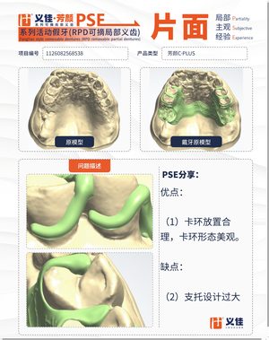 1126082568538 可摘局部义齿支架 PSE 片面记录卡案例