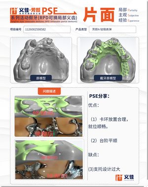 1126082598582 可摘局部义齿支架 PSE 片面记录卡案例