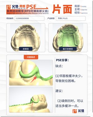 1126082608698 可摘局部义齿支架 PSE 片面记录卡案例