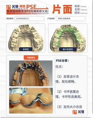 1126082608712 可摘局部义齿支架 PSE 片面记录卡案例