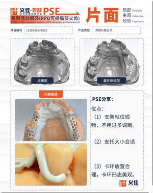 1126082648652 可摘局部义齿支架 PSE 片面记录卡案例