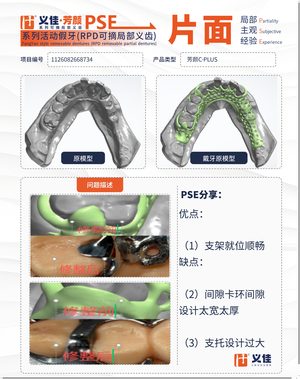 1126082668734 可摘局部义齿支架 PSE 片面记录卡案例