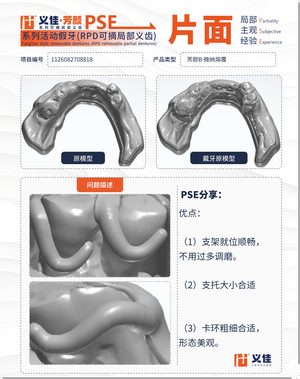 1126082708818 可摘局部义齿支架 PSE 片面记录卡案例
