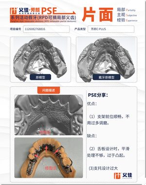 1126082768816 可摘局部义齿支架 PSE 片面记录卡案例