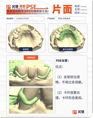 1126082778764 可摘局部义齿支架 PSE 片面记录卡案例